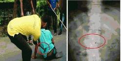 Injured Tariqul sent to Dhaka for better treatment