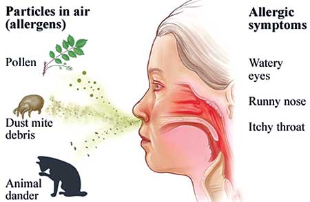Allergic rhinitis in spring