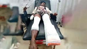 2 injured in landmine explosions along Bandarban border