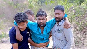 Bangladeshi man loses leg in landmine blast along Myanmar border