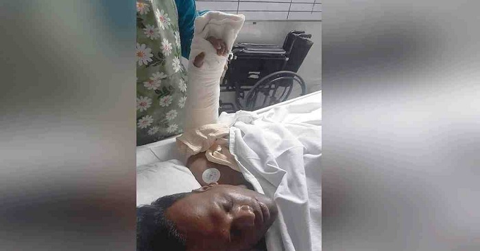 Doctors successfully transplanted the wrist of a police constable of Lohagara police station in Chattogram early Monday