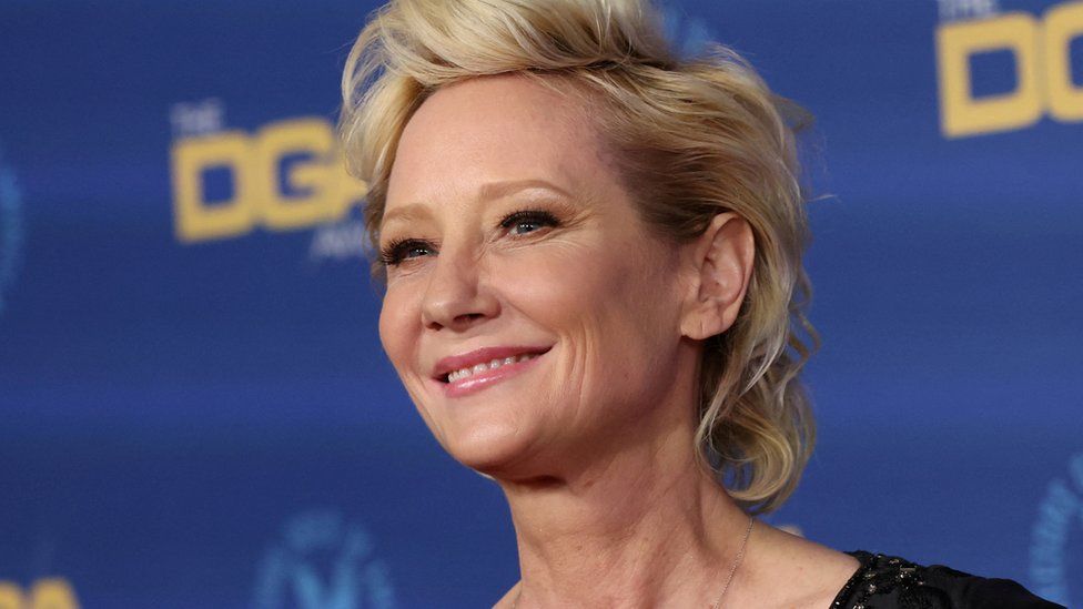 Anne Heche remains on life support for donor evaluation